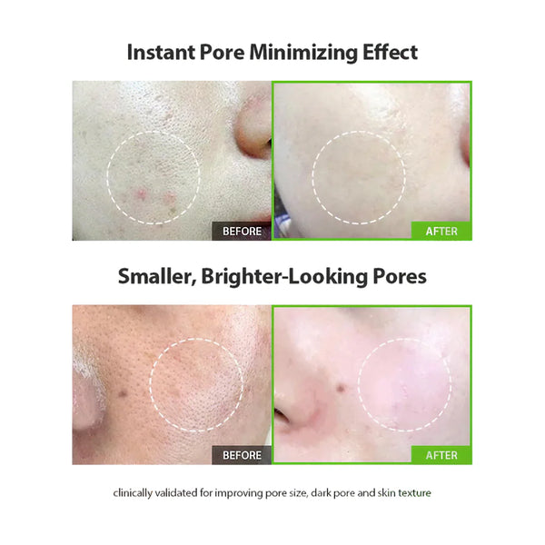Green Tomato Pore Lifting Ampoule+ 30ml