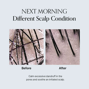Damage Therapy Scalp Scaling Ampoule 30ml