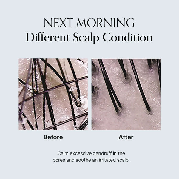 Damage Therapy Scalp Scaling Ampoule 30ml