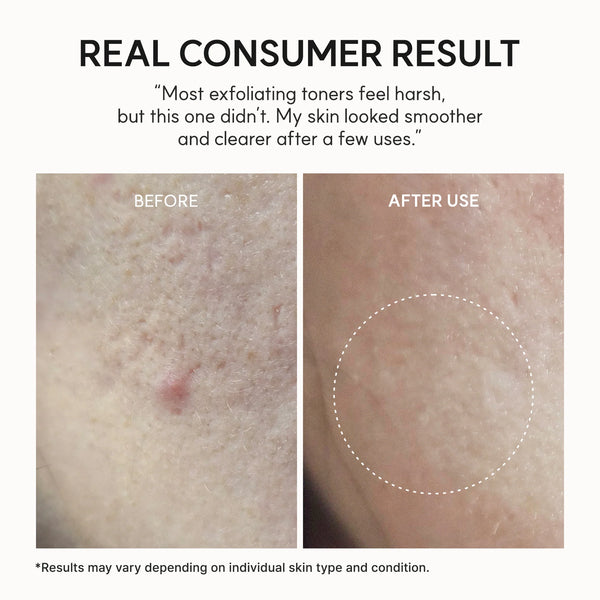 Eraser Shot Glycolic Acid Exfoliator 200ml