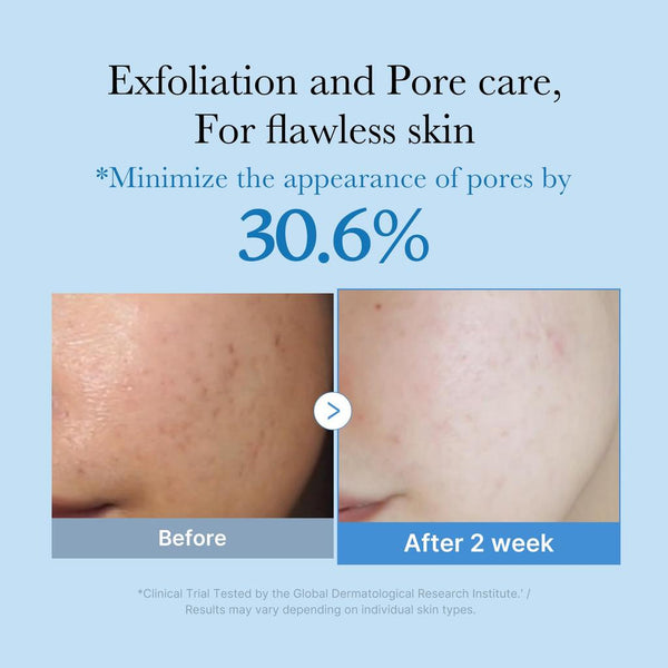 Zero Pore Toner 250ml