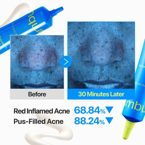 Zero Blemish 3X Spot Correcting Cream 20ml