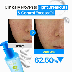 Zero Blemish Oil-Free Micellar Cleansing Jelly 200ml