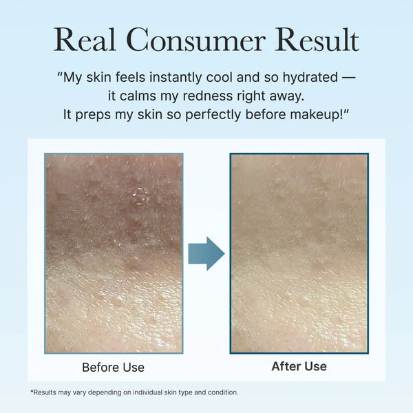 PDRN + Hyaluronic Deep Hydration Pads 90stk