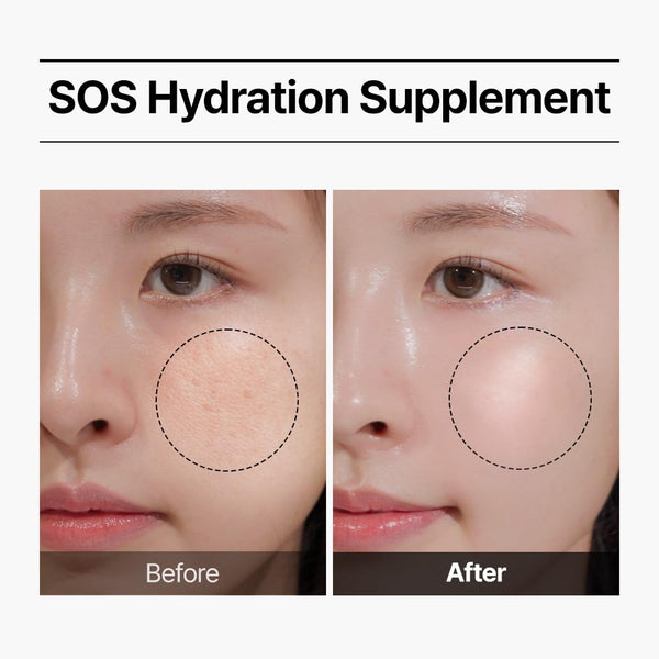 Real Hyaluronic one day set