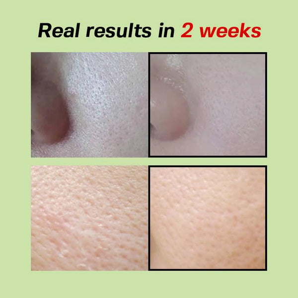 Green Tomato Pore Lifting Ampoule+ 30ml