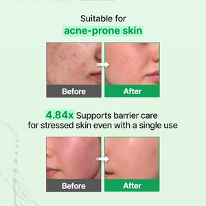 EGF Skin Barrier Cream Toner 150ml