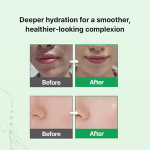 EGF Skin Barrier Hydro Ampoule 30ml
