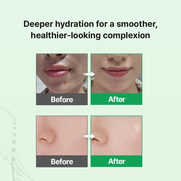 EGF Skin Barrier Hydro Ampoule 30ml