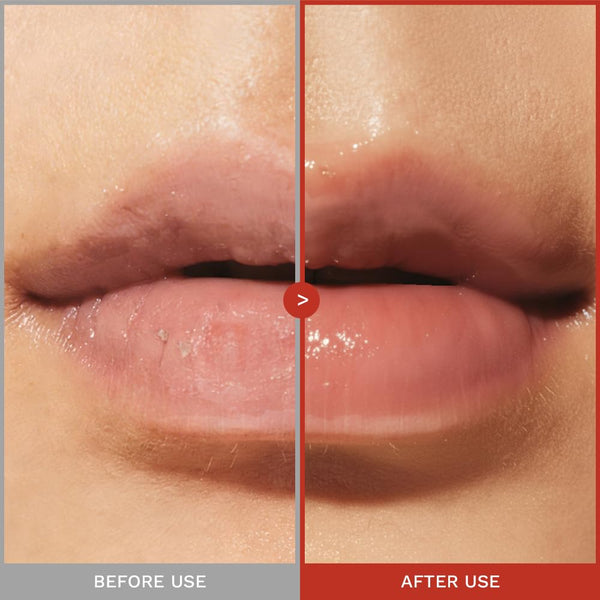 Rose PDRN Peptide Glowy balm 10ml