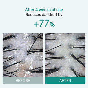 SCALP:TURN CICA PDRN BRUSH Ampoule 100ml