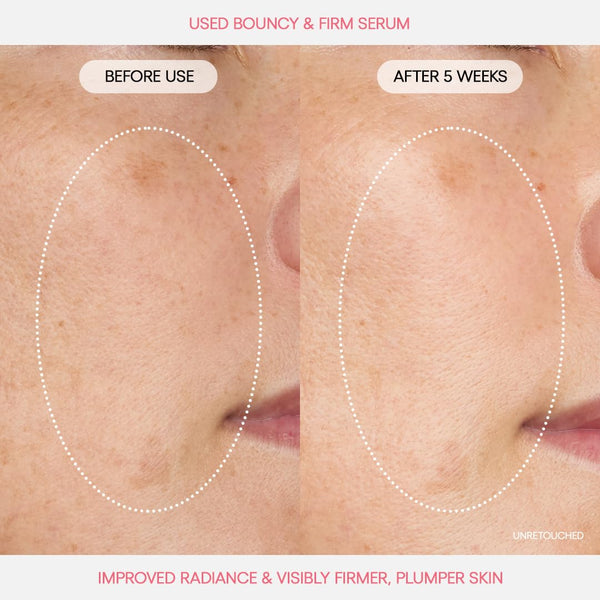Bouncy & Firm Serum 30ml