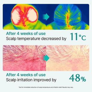 SCALP:TURN CICA PDRN BRUSH Ampoule 100ml