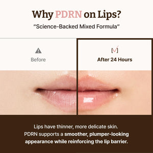 Advanced PDRN Rejuvenating Lip Serum 10ml