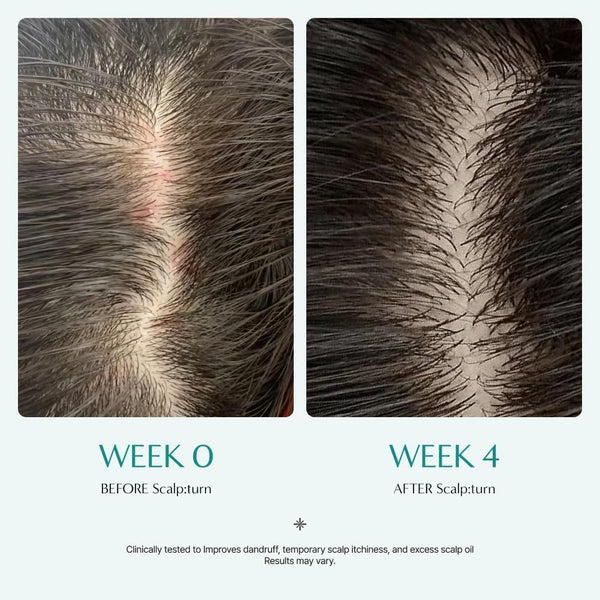 SCALP:TURN CICA PDRN BRUSH Ampoule 100ml