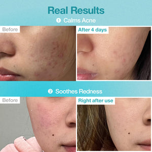 No.1 Pantothenic B5 Hyaluronic Active Clear Mask