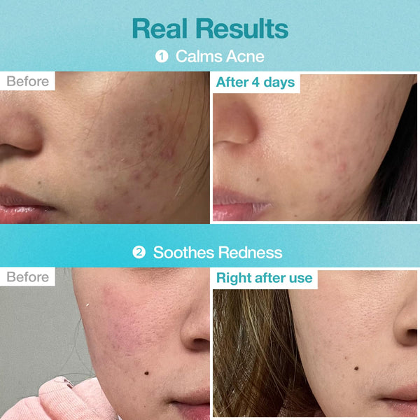 No.1 Pantothenic B5 Hyaluronic Active Clear Mask