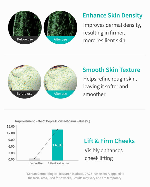 REJURAN® Turnover Ampoule 30ml