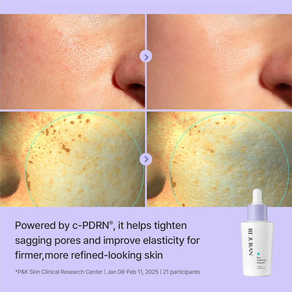 Derma Pore Tightening Ampoule 30ml