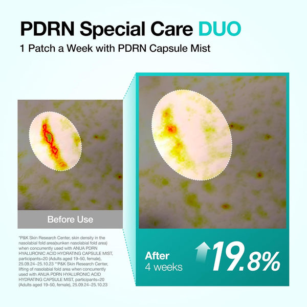 PDRN Collagen Melting Patch for Glass skin - Smile line patches