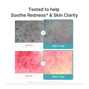 Azelaic Acid Capsule Foam Cleanser 120ml