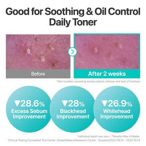No.1 Pure-full Calming Herb Toner 300ml