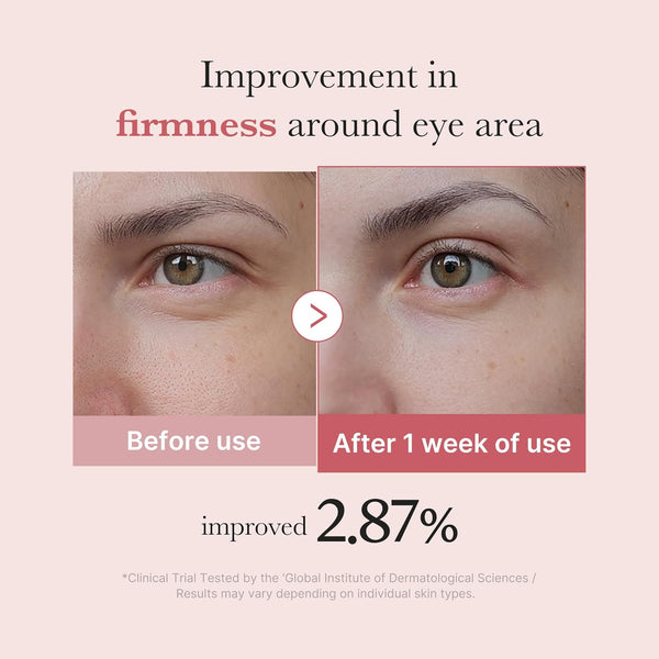 PDRN Pink Peptide Eye Cream 30ml