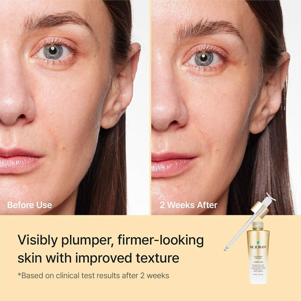 REJURAN® Dual Effect Ampoule 50ml