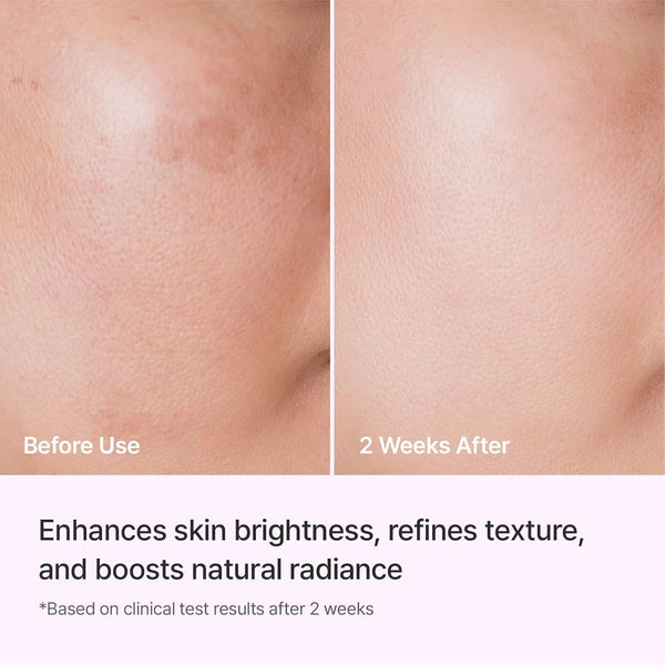 REJURAN Triple Radiance Ampoule 30ml