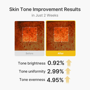 Kojic Acid Turmeric Capsule Cream