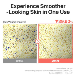 No.3 Tingle-Pore Softening Sheet Mask