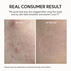 SOS Relief Mask 20ml