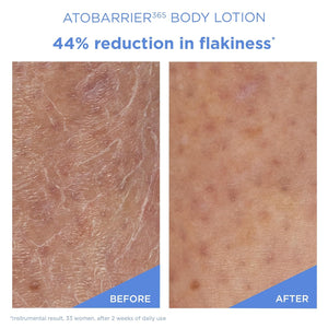 Ato Barrier 365 Body Lotion 400ml