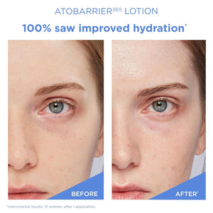 Ato Barrier 365 Lotion 150ml