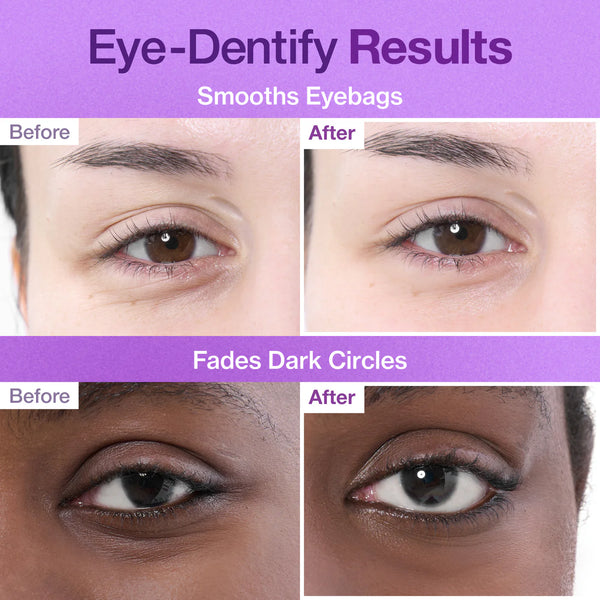 No.9 NAD Collagen Under Eye Patches 5 par