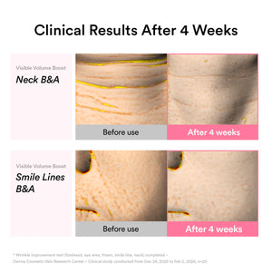 PDRN Volume fill-it Booster crème 2.5 tube 30ml