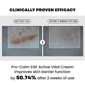 EGF Active Vital Cream 20ml