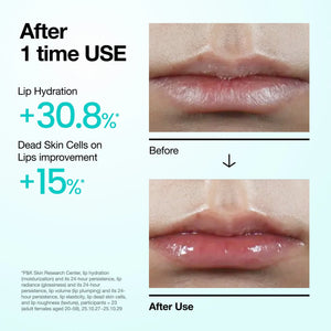 PDRN Lip Serum 10ml